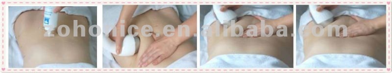 FAST Slimming 5 in 1 fat freezing ultrasonic cavitation rf vacuum and roller massage