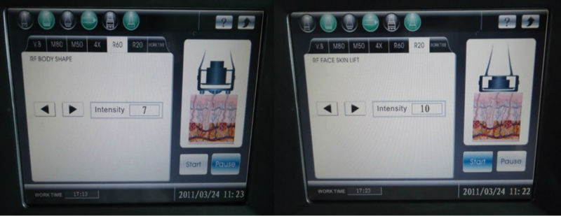 2013 Cavitation RF Ultrasonic machine S80C ISO/CE multipolar rf vacuum cavitation