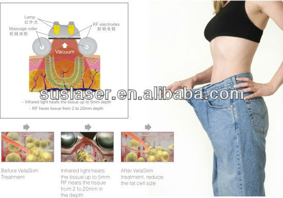 2013new!!!electrode stimulation weight loss equipment s80 CE/ISO electrode stimulation weight loss equipment