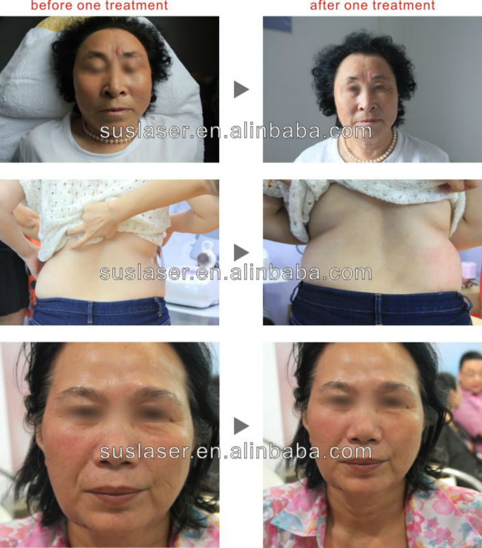 2013new!!!electrode stimulation weight loss equipment s80 CE/ISO electrode stimulation weight loss equipment