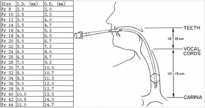 Длина трубки. Размеры эндотрахеальных трубок таблица. Диаметр эндотрахеальных трубок. Диаметр интубационной трубки. Размер эндотрахеальной трубки для детей.