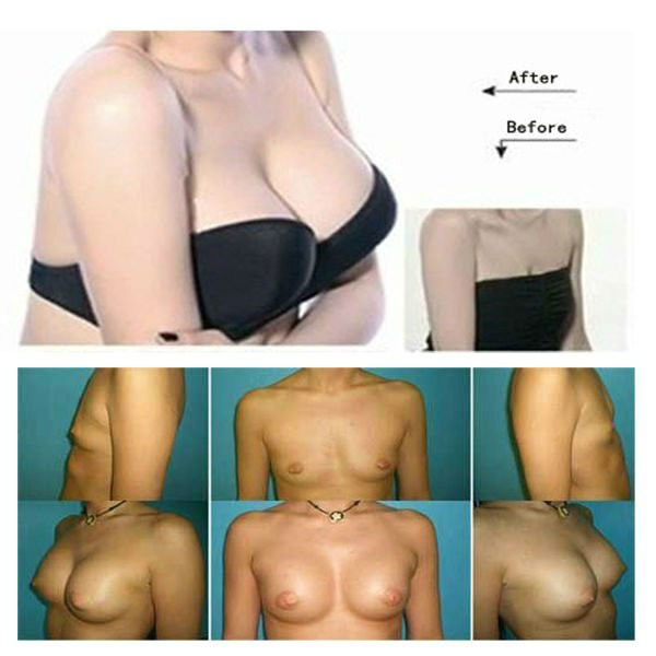 Enlarging mens breast are absolutely Enlarging mens breast thanks