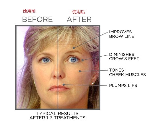 Face Master Facial Tone Tighten Skin Care ANTI AGING
