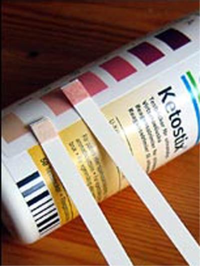 Ketostix Test Urine - Buy Urine Dip Sticks Test Urine 