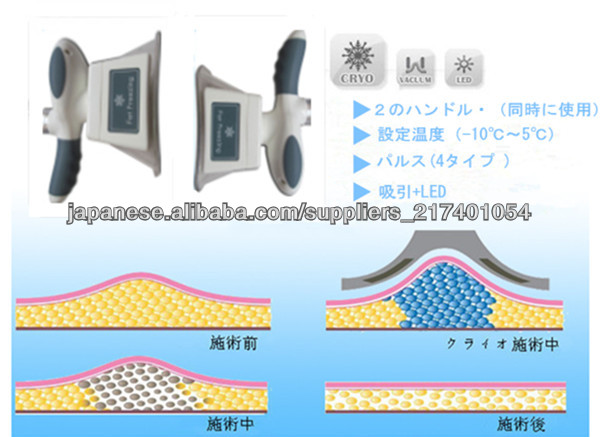 キャビテーション/キャビハイフ/キャビRF/脂肪冷却 | angeloawards.com